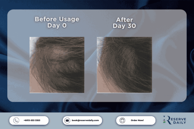 Customer review for exosome hair revival spray showing hair regrowth results